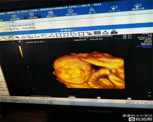 广州代孕是骗人的吗,孕期必定要经历的六种痛，
