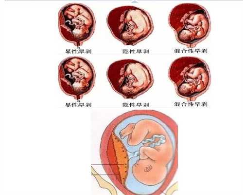 广州2020年代孕宝宝_孕妇流血吃什么