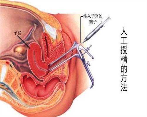 广州人工授精代孕中介：广州代怀孩子价格_广州代孕要花多少钱