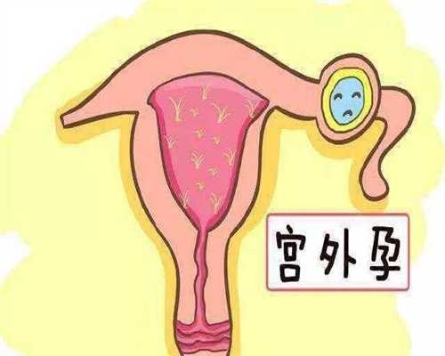 广州怎么生龙凤胎：广州代孕生子多少钱_广州职业代孕