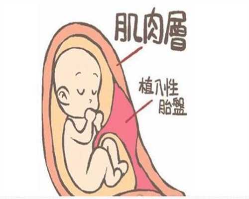 广州保定代孕：广州代怀孕咨询_广州代怀孕地址